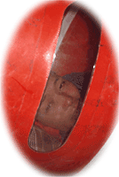 sick porter with HAPE treated in a portable altitude chamber